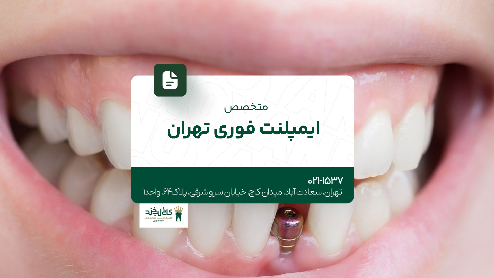 متخصص ایمپلنت فوری در تهران متخصص ایمپلنت فوری در تهران