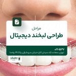 مراحل طراحی لبخند دیجیتال