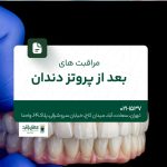 مراقبت های بعد از پروتز دندان