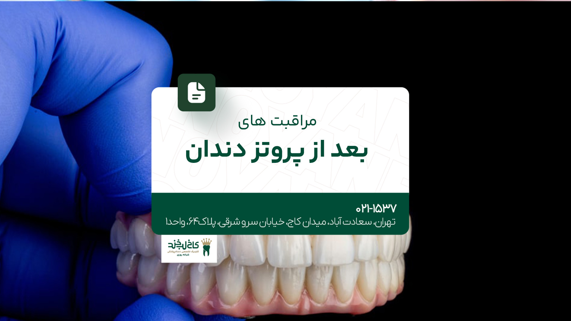 مراقبت های بعد از پروتز دندان مراقبت های بعد از پروتز دندان