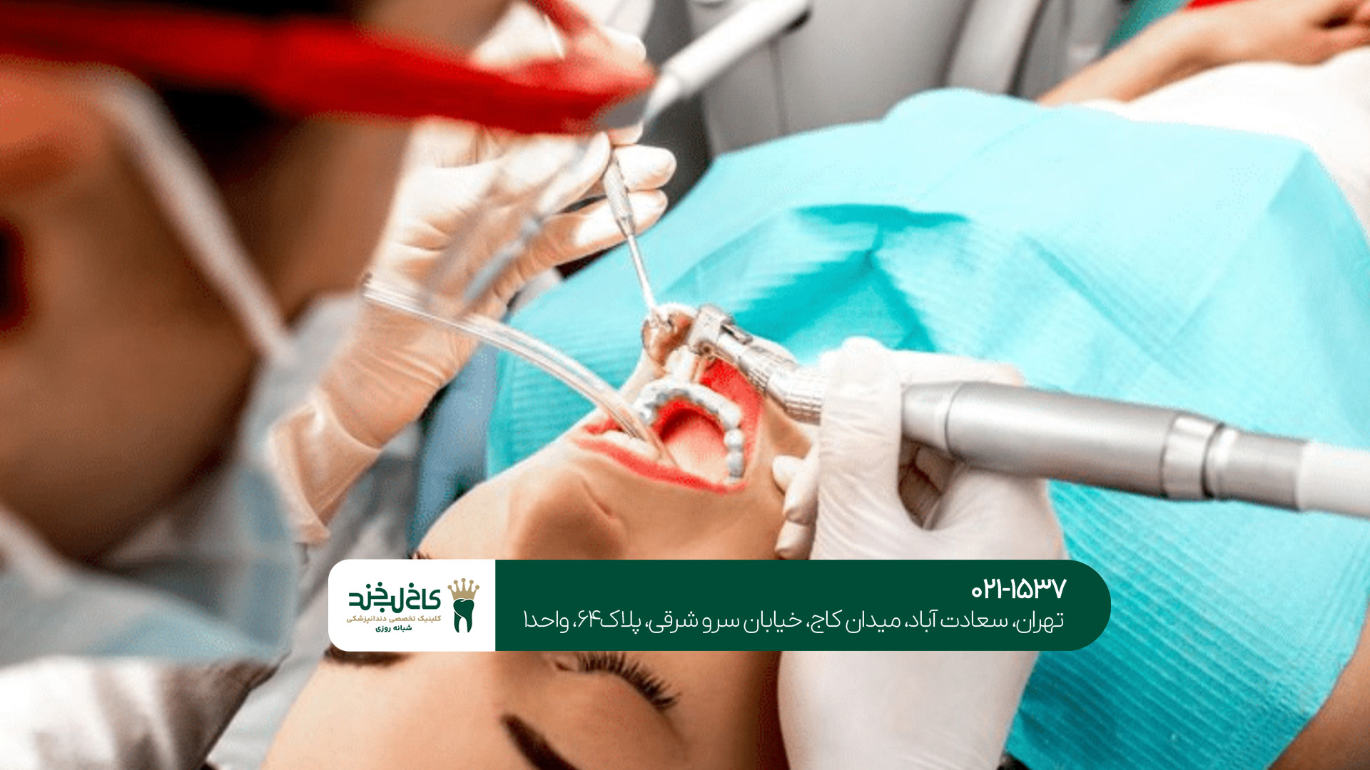 مراقبتها و نکات مهم بعد از درمان دندان مراقبتها و نکات مهم بعد از درمان دندان