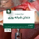 مرکز ایمپلنت دندان شبانه روزی