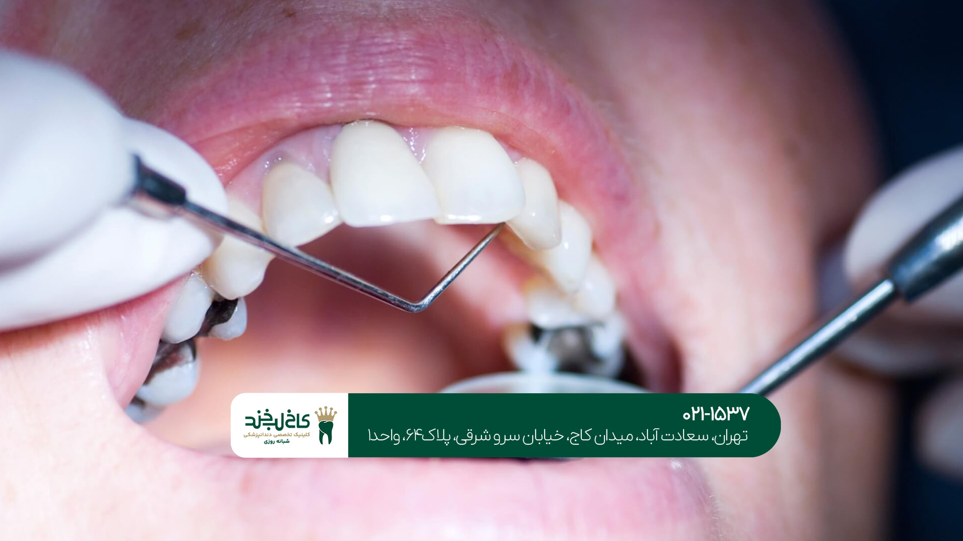 مرکز دندانپزشکی حرفه‌ای در تهران