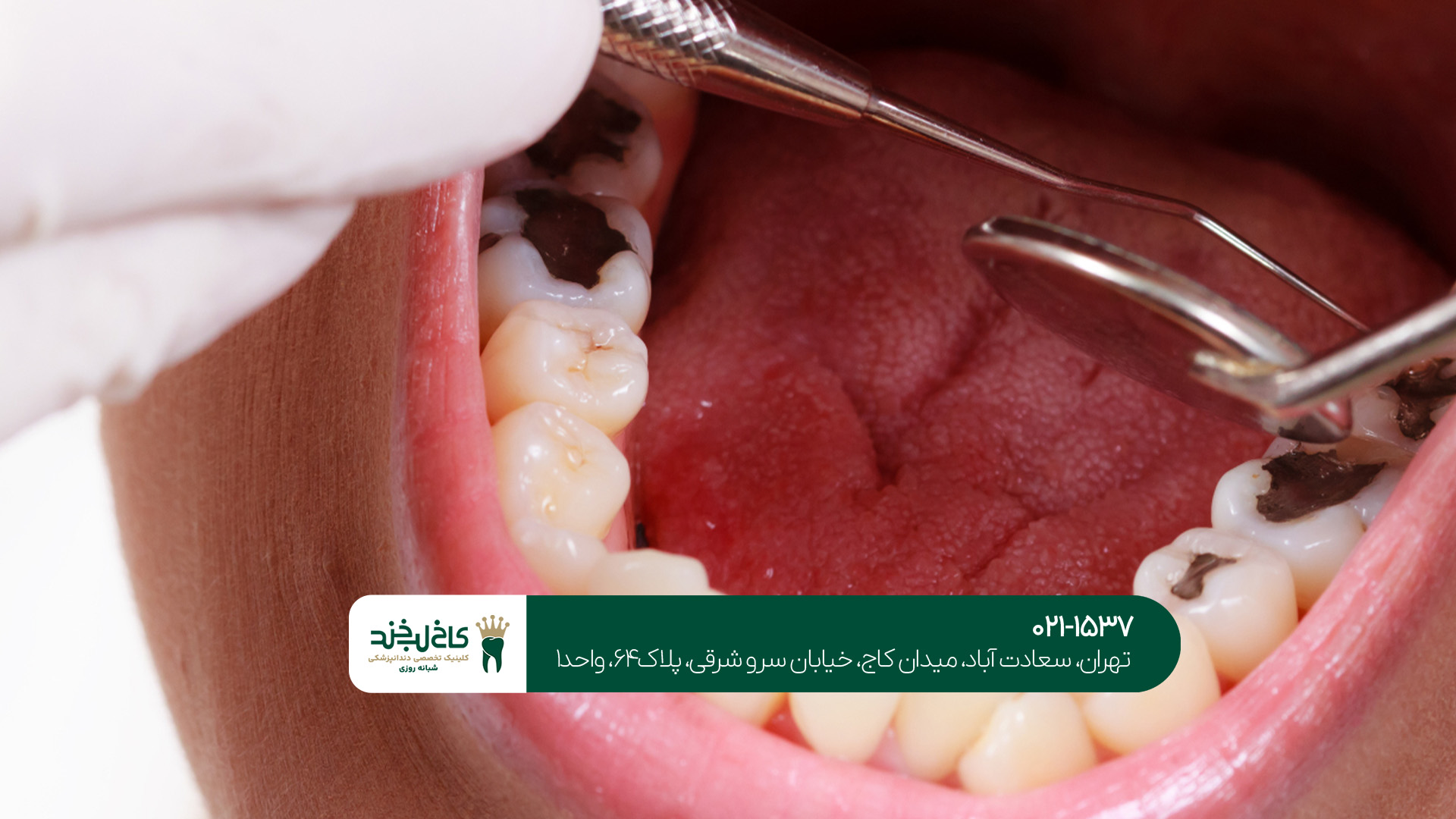 مرکز دندانپزشکی حرفه‌ای در تهران