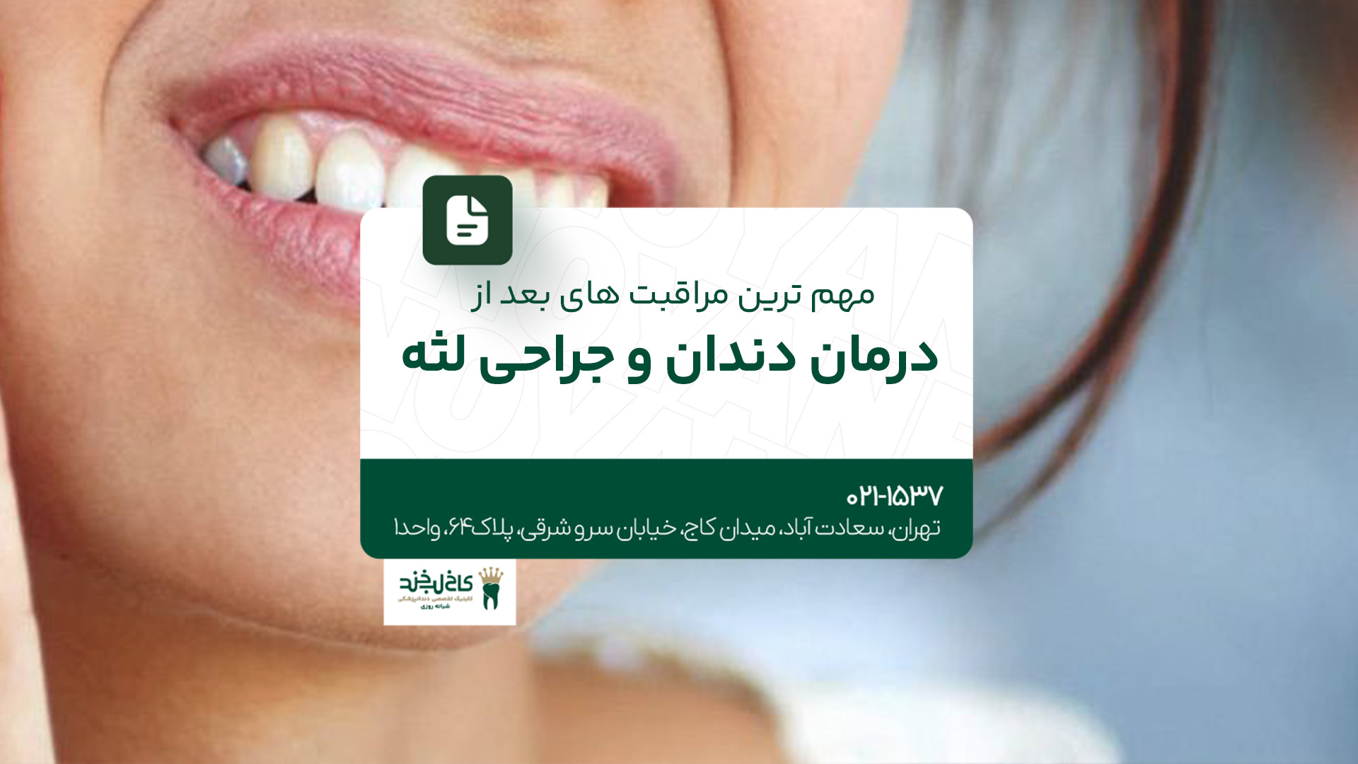 مهم‌ترین مراقبت‌های بعد از درمان دندان و جراحی لثه