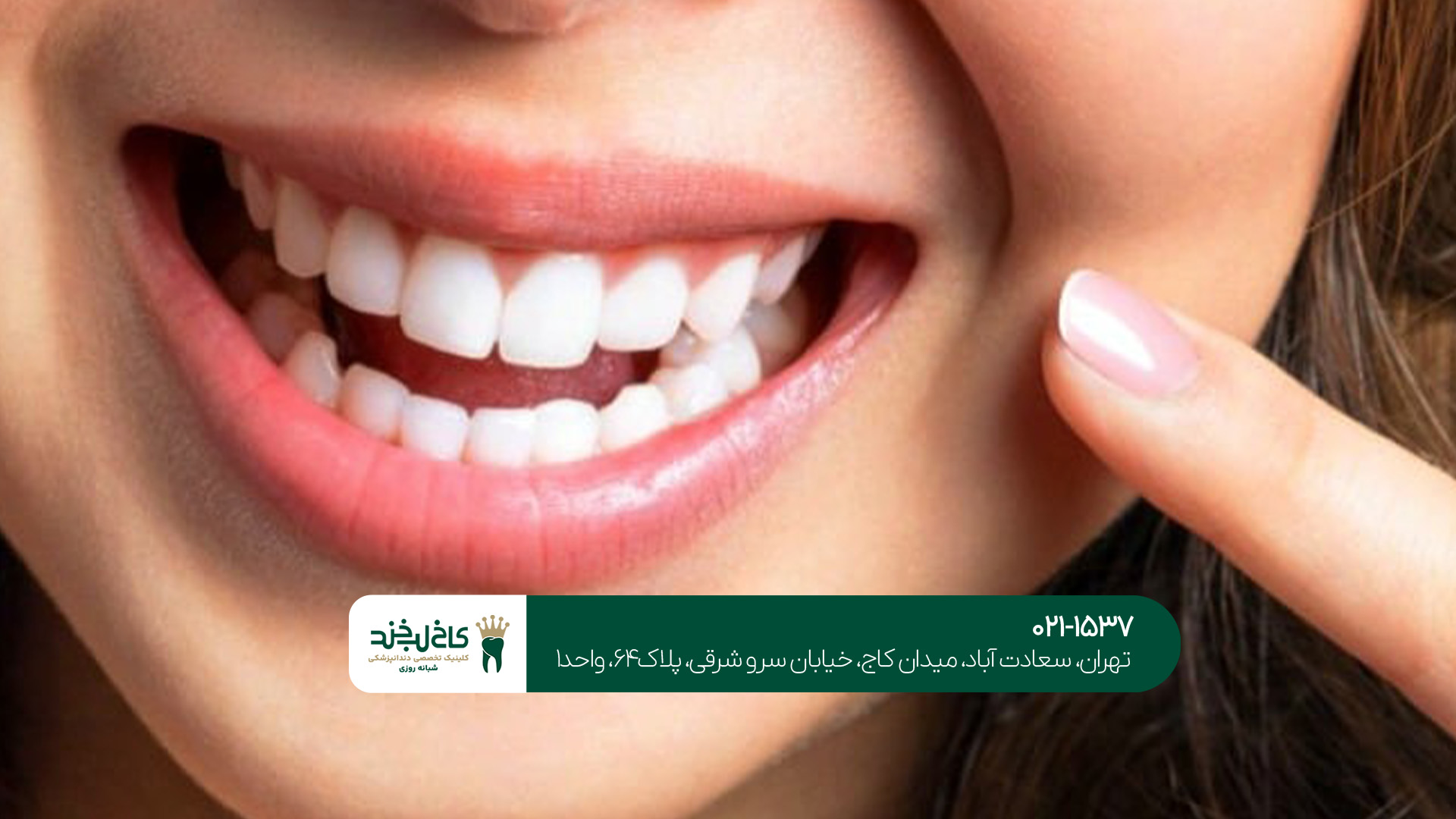 مهم‌ترین مراقبت‌های بعد از درمان دندان و جراحی لثه