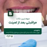 مهمترین نکات مراقبتی بعد از لمینت
