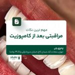 مراقبت های بعد از کامپوزیت