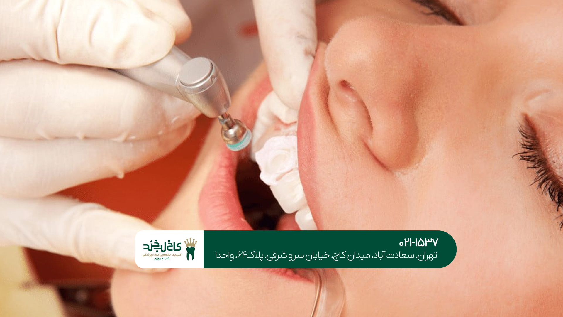 مواد مورد استفاده در کامپوزیت مواد مورد استفاده در کامپوزیت