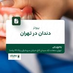 پروتز دندان در تهران