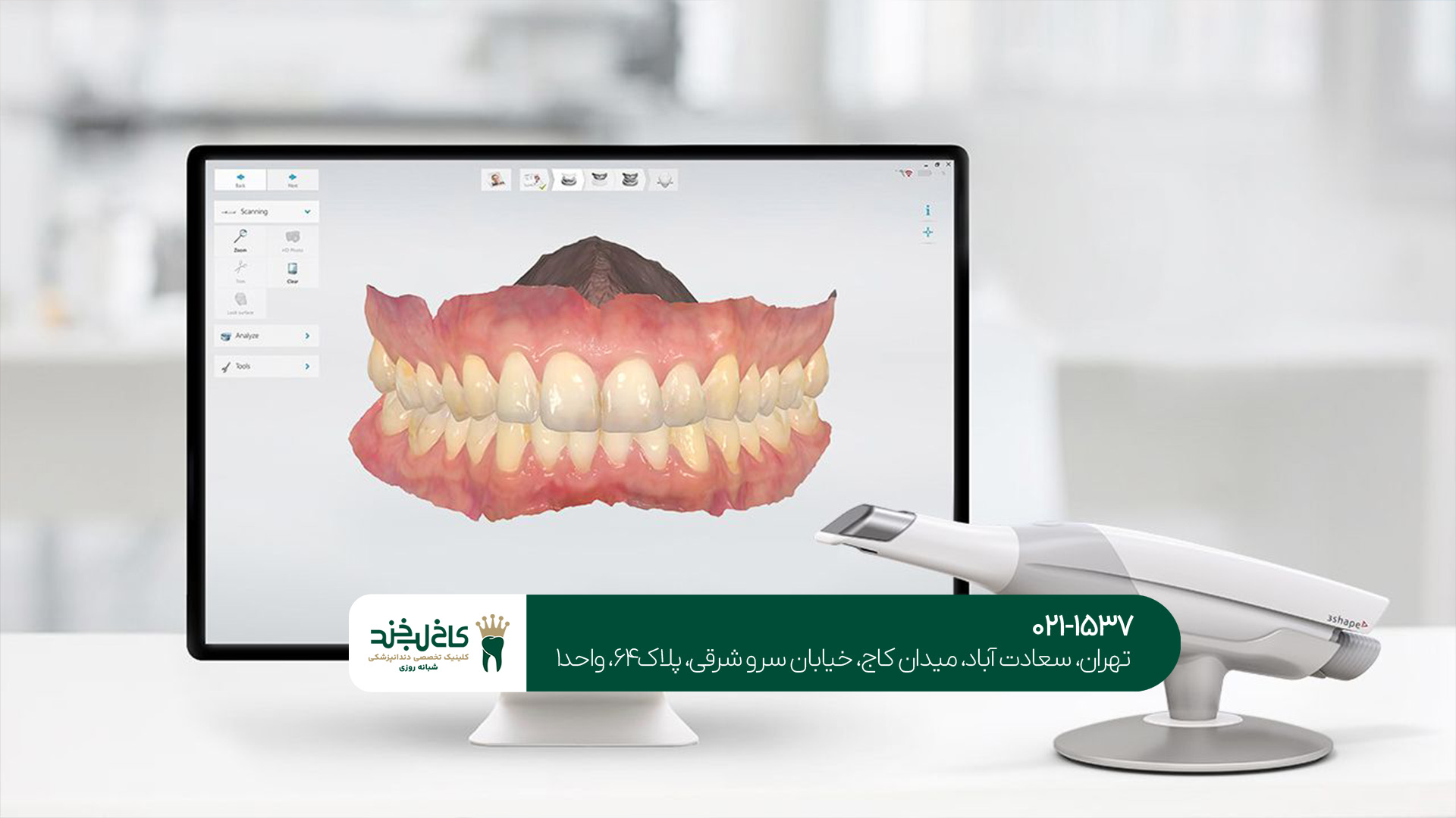 پروتز دندان دیجیتال پروتز دندان دیجیتال