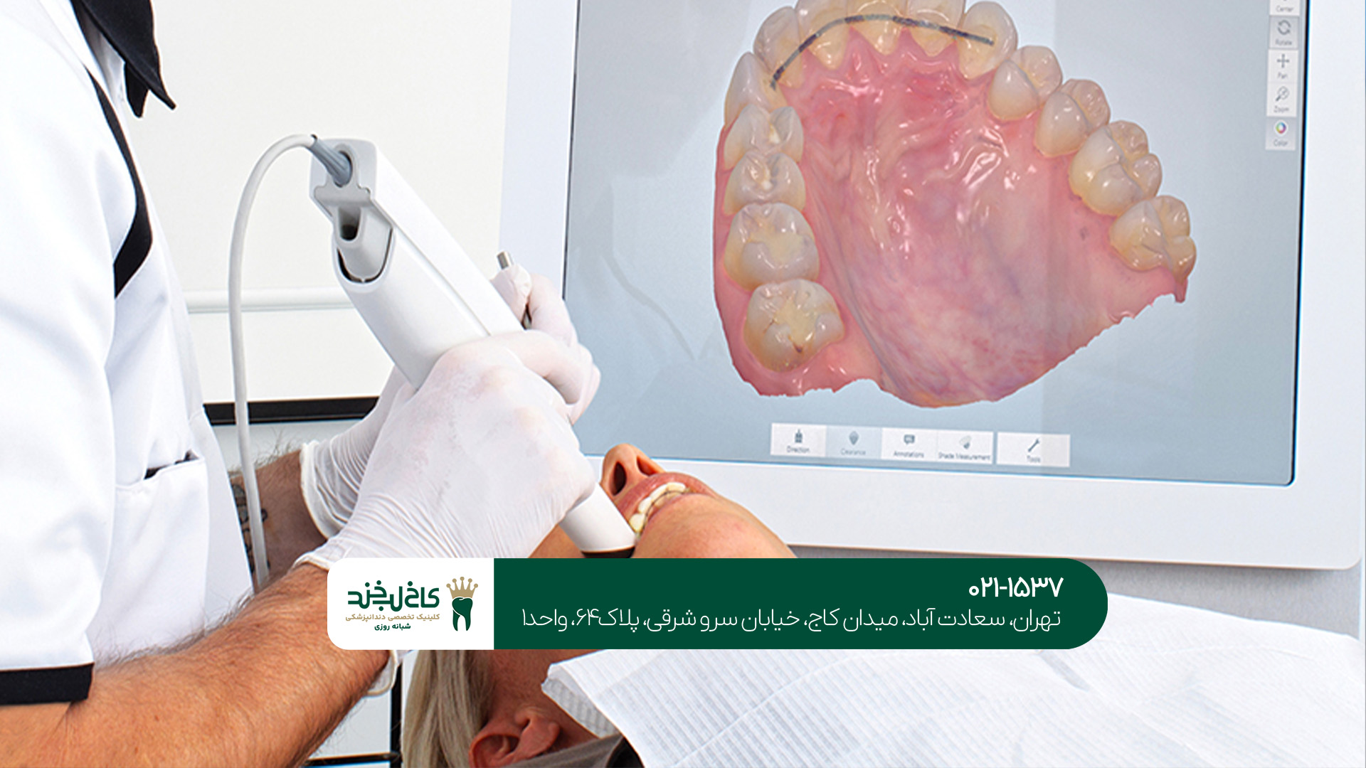 پروتز دندان دیجیتال پروتز دندان دیجیتال