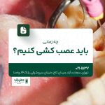 چه زمانی باید عصب‌کشی کنیم؟