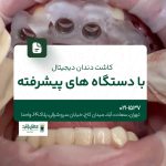 کاشت دندان دیجیتال با دستگاه‌های پیشرفته