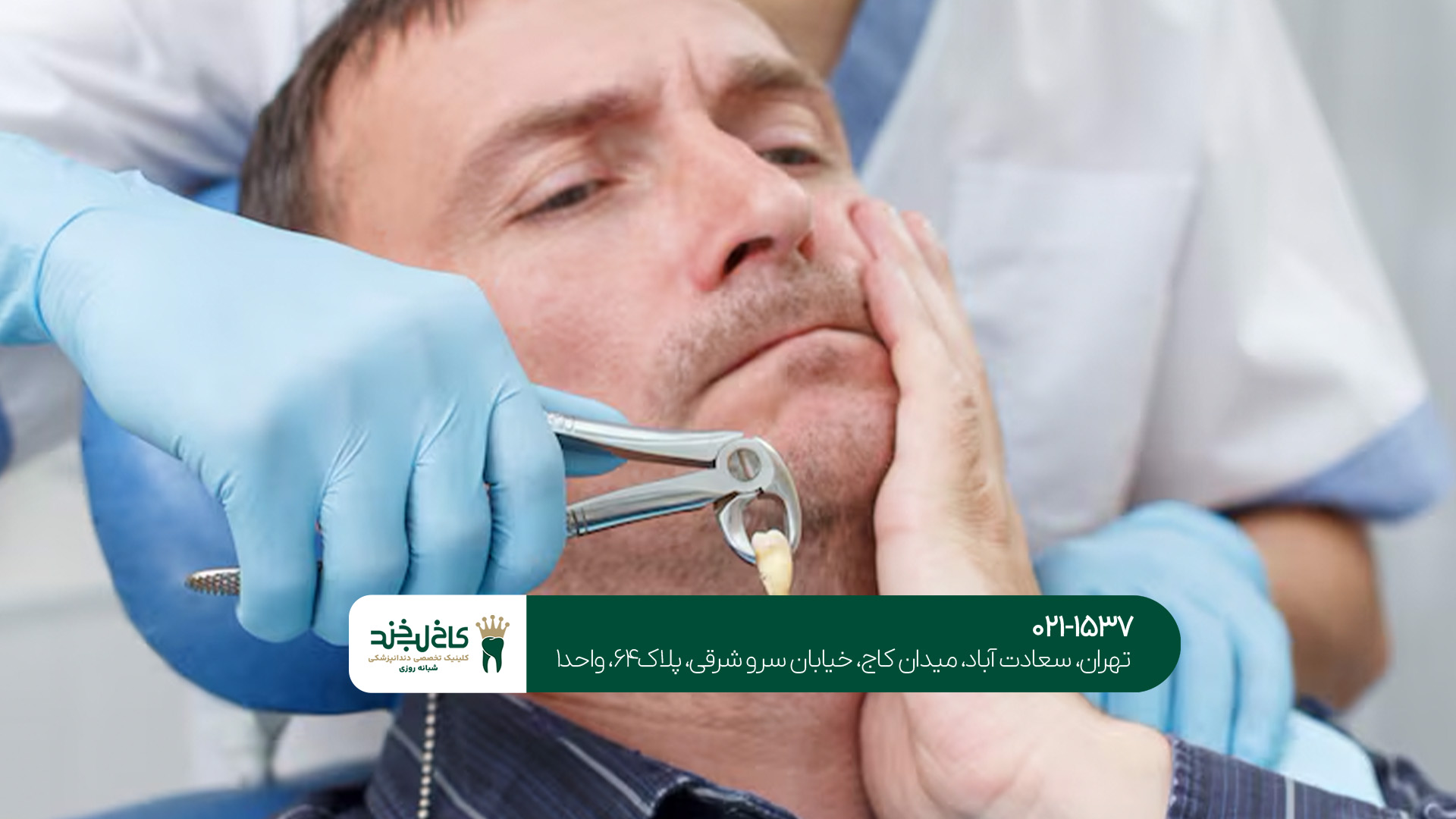 کشیدن دندان عقل در تهران کشیدن دندان عقل در تهران