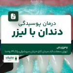 درمان پوسیدگی دندان با لیزر