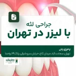 جراحی لثه با لیزر در تهران