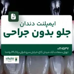ایمپلنت دندان جلو بدون جراحی
