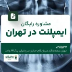 مشاوره رایگان ایمپلنت در تهران
