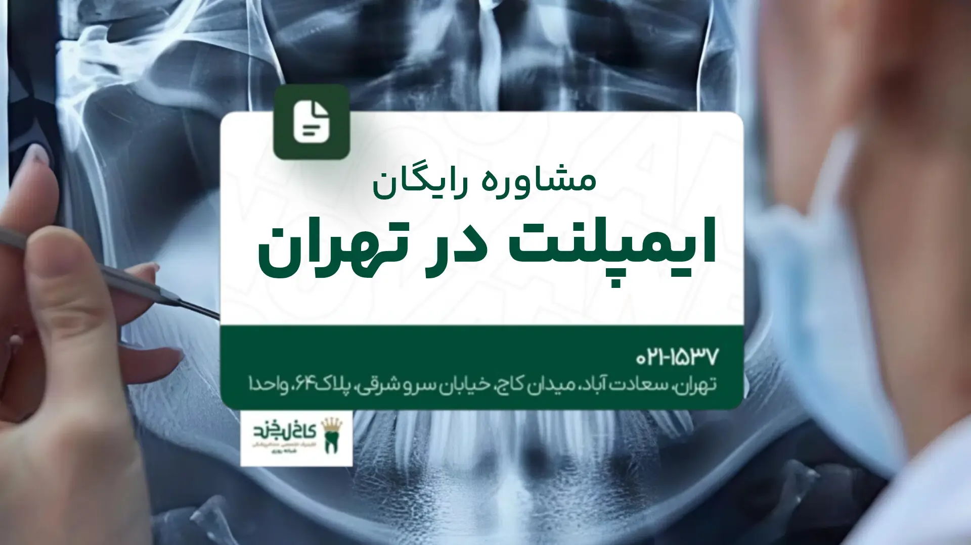 مشاوره رایگان ایمپلنت در تهران