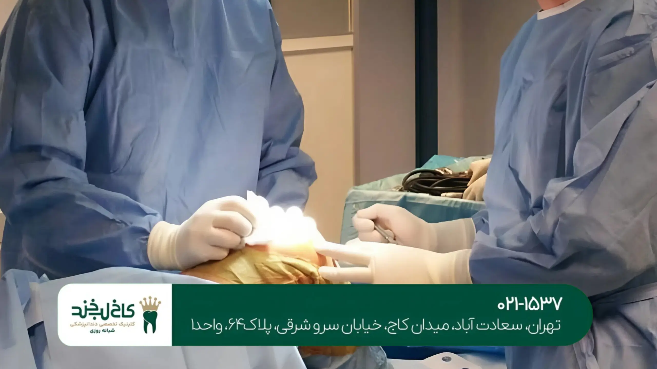 مشاوره رایگان ایمپلنت در تهران