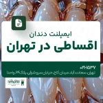 ایمپلنت دندان اقساطی در تهران