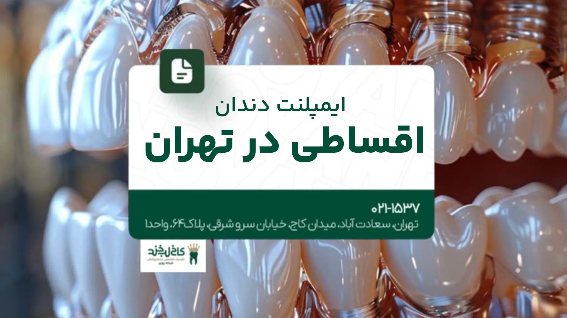 ایمپلنت دندان اقساطی در تهران