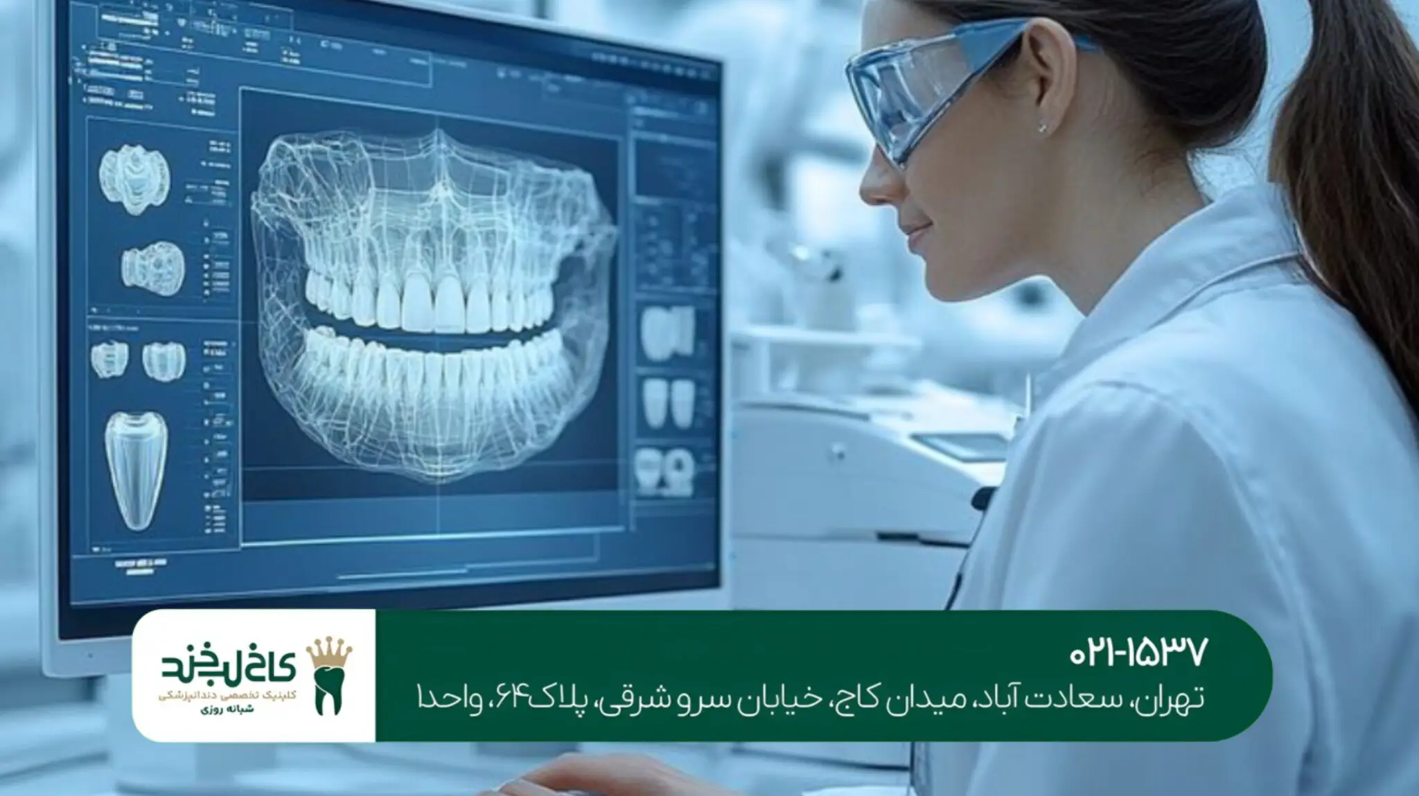 بهترین مرکز ایمپلنت دیجیتال تهران