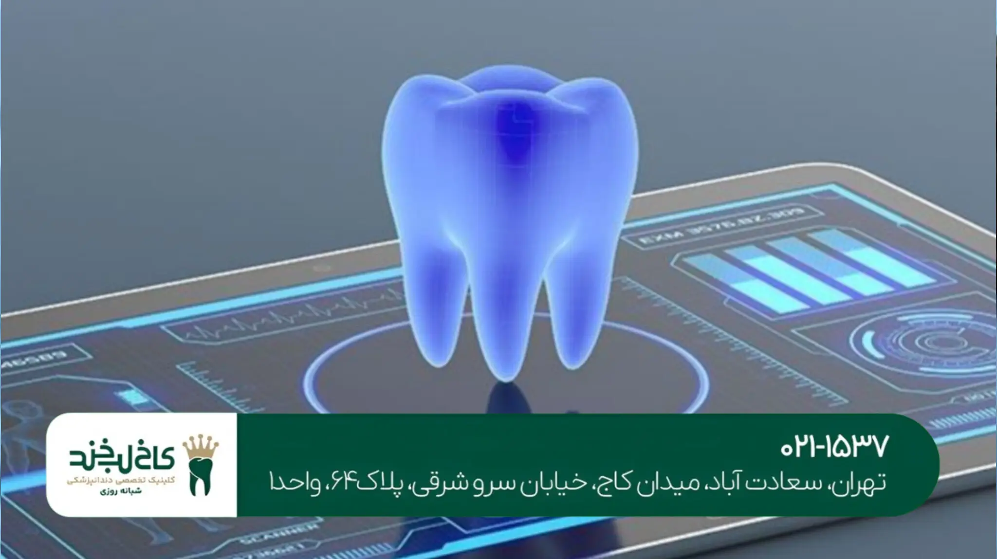 بهترین مرکز ایمپلنت دیجیتال تهران