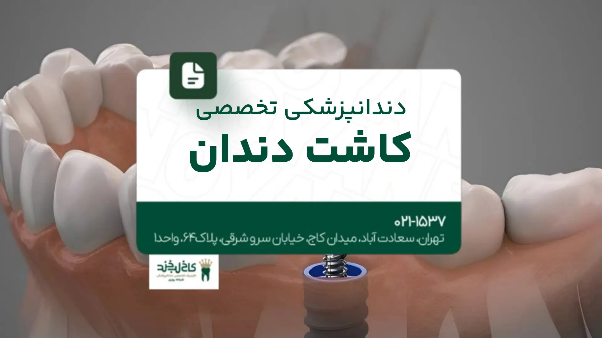 دندانپزشکی تخصصی کاشت دندان