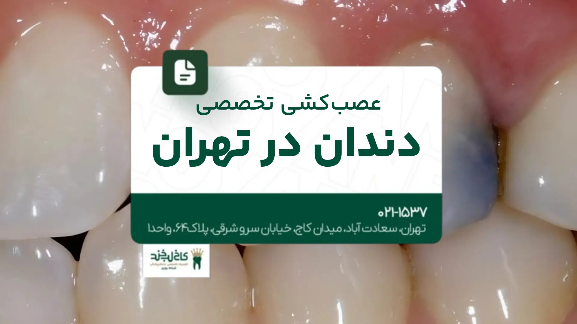 عصب‌کشی تخصصی دندان در تهران