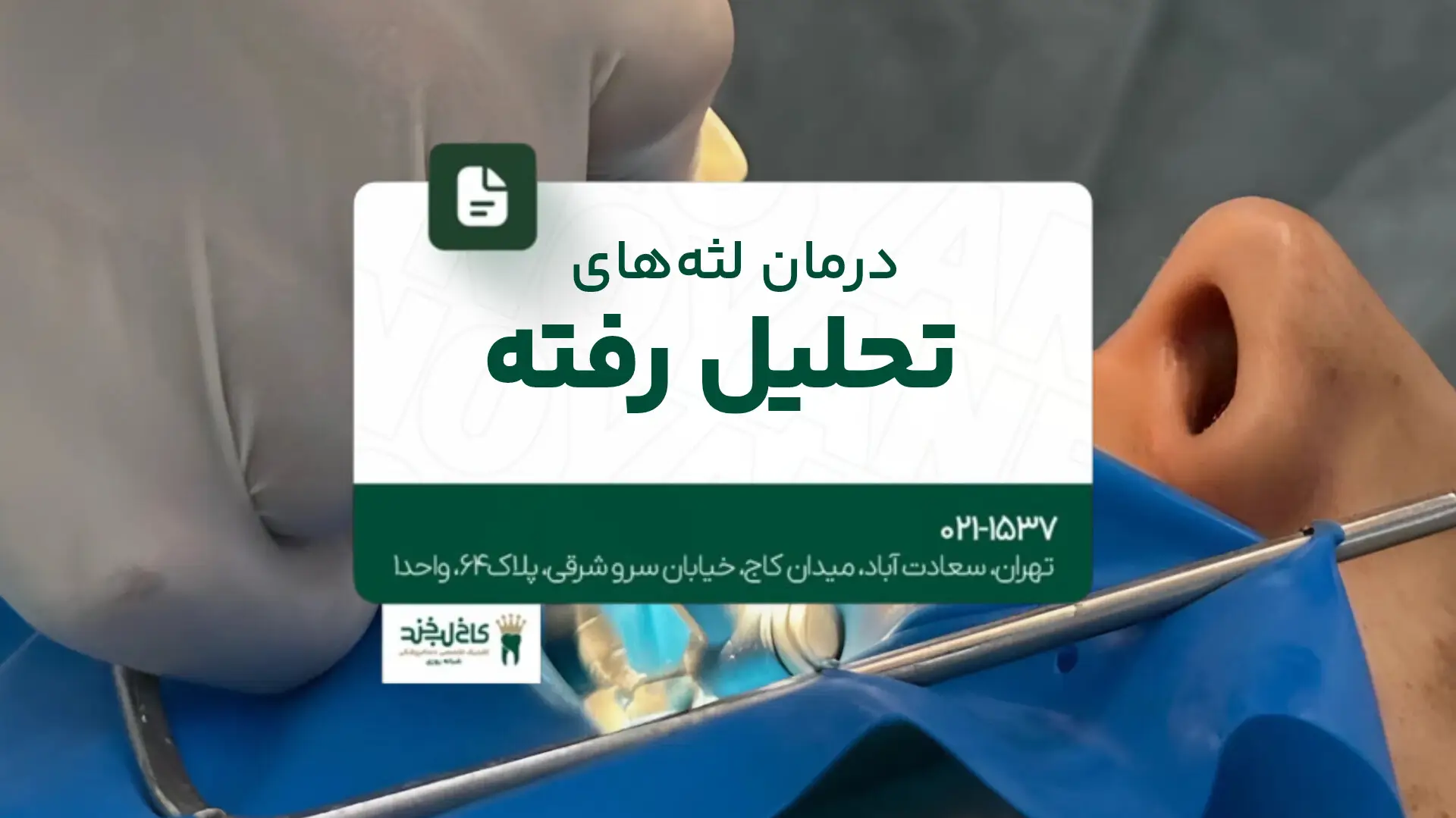 درمان لثه های تحلیل رفته