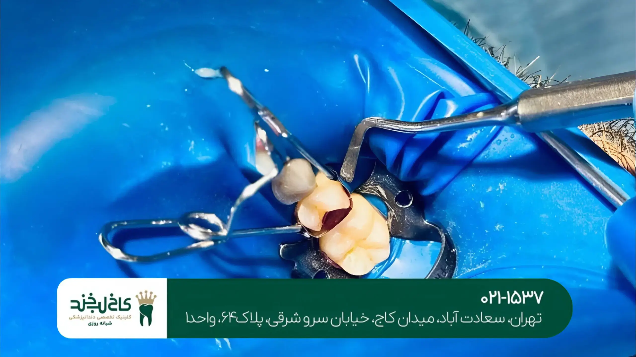 بهترین دندانپزشکی زیبایی شمال تهران