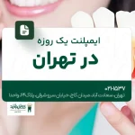 ایمپلنت یک روزه در تهران