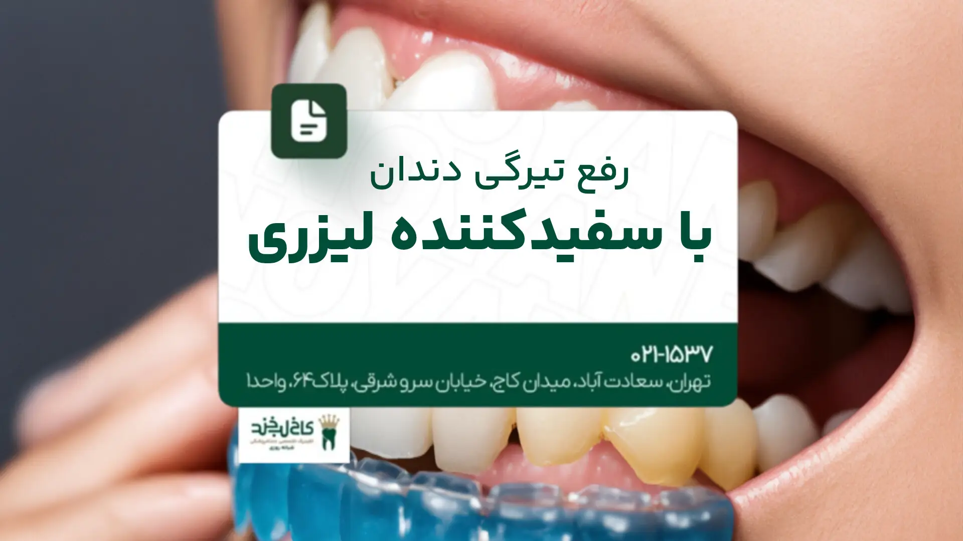 رفع تیرگی دندان با سفیدکننده لیزری