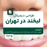 طراحی دیجیتال لبخند در تهران