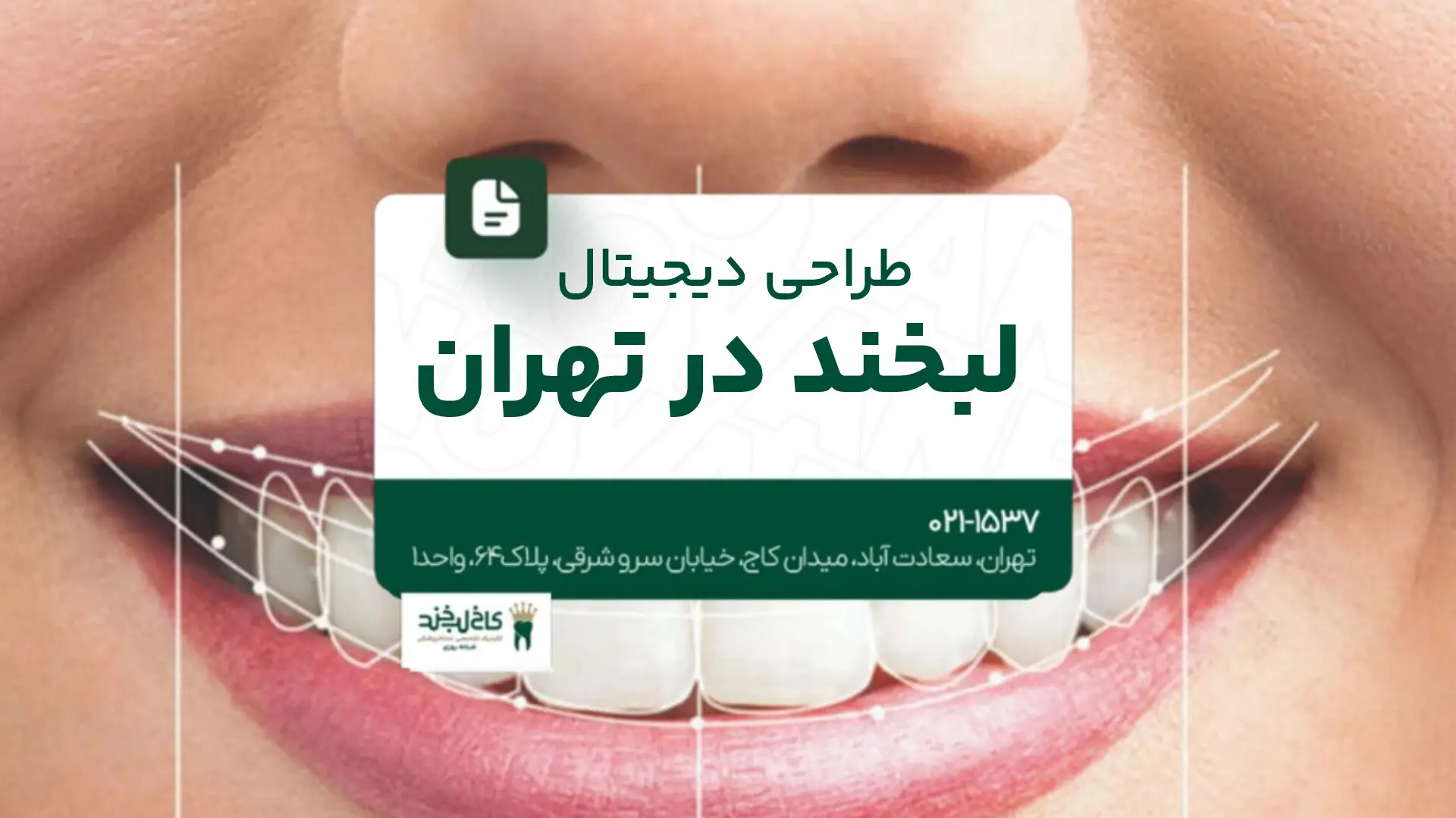 طراحی دیجیتال لبخند در تهران