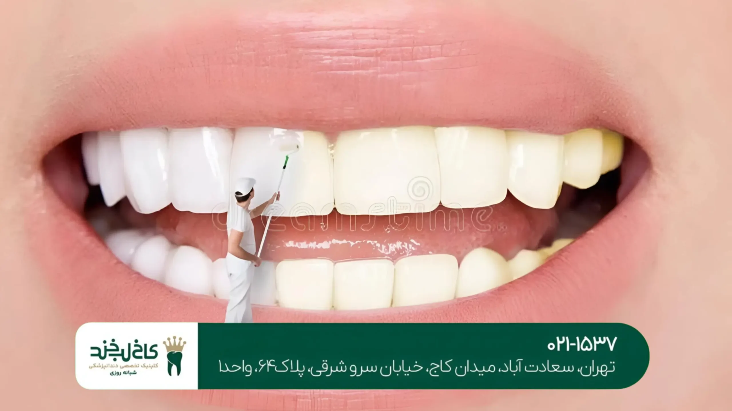 طراحی دیجیتال لبخند در تهران