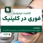 کاشت ایمپلنت فوری