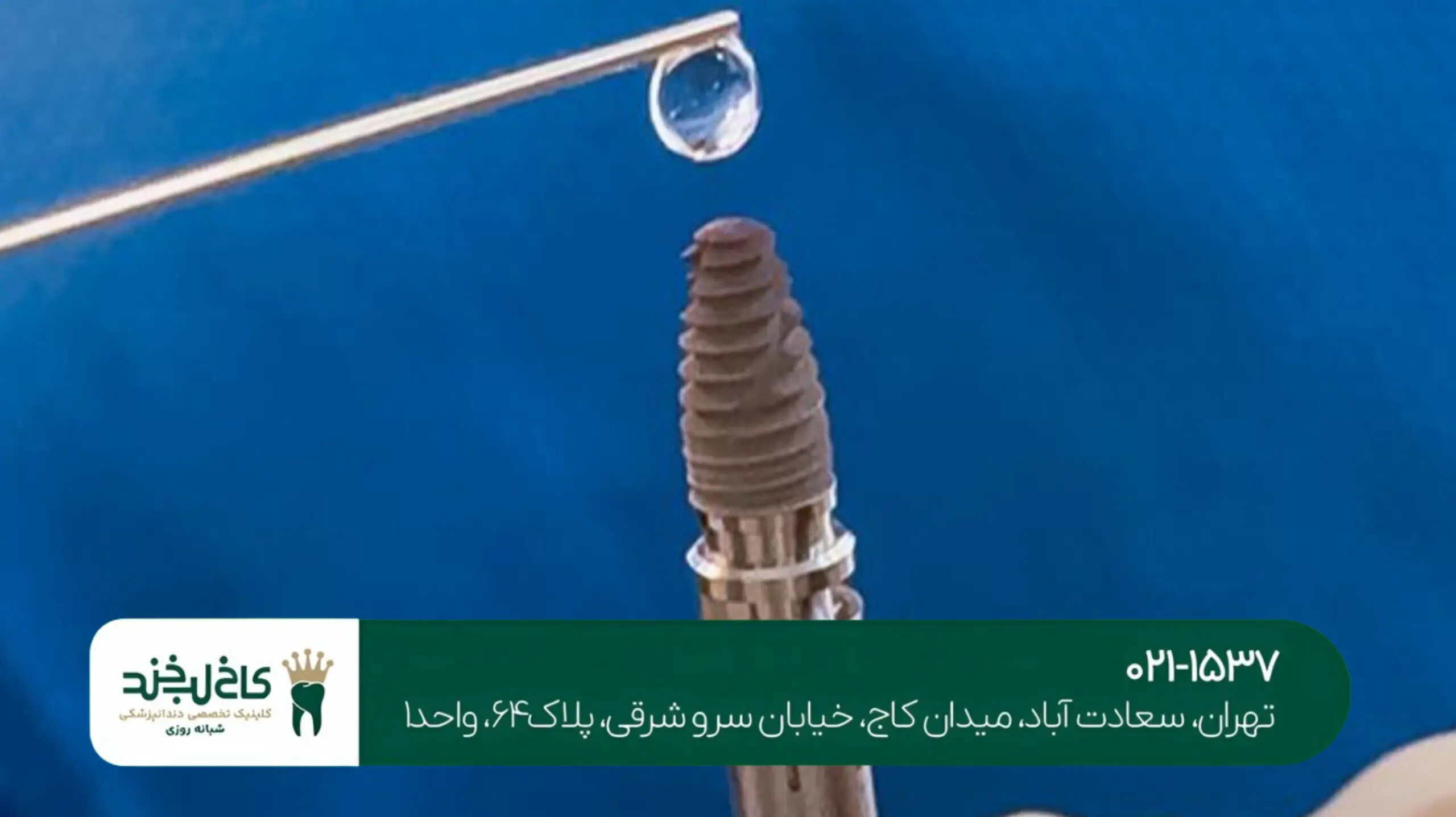 کاشت ایمپلنت فوری