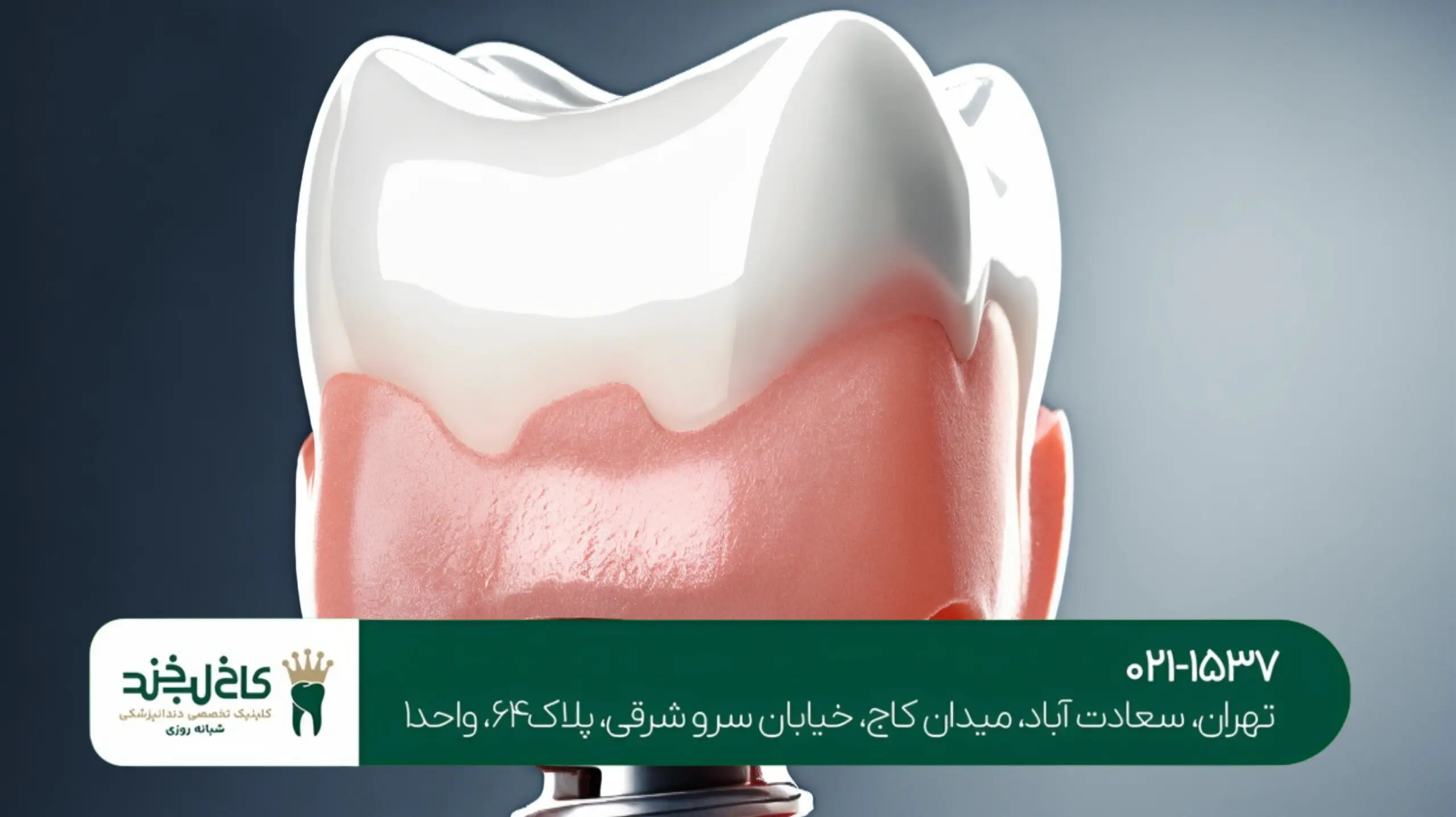 کاشت ایمپلنت فوری