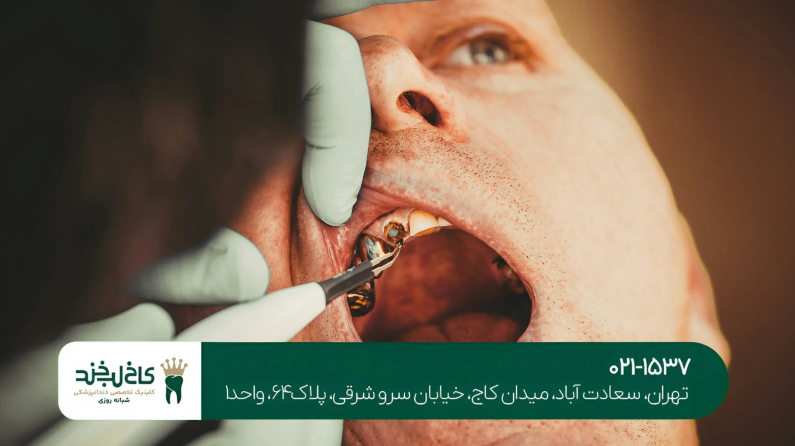 درمان دندان درد شدید با لیزر