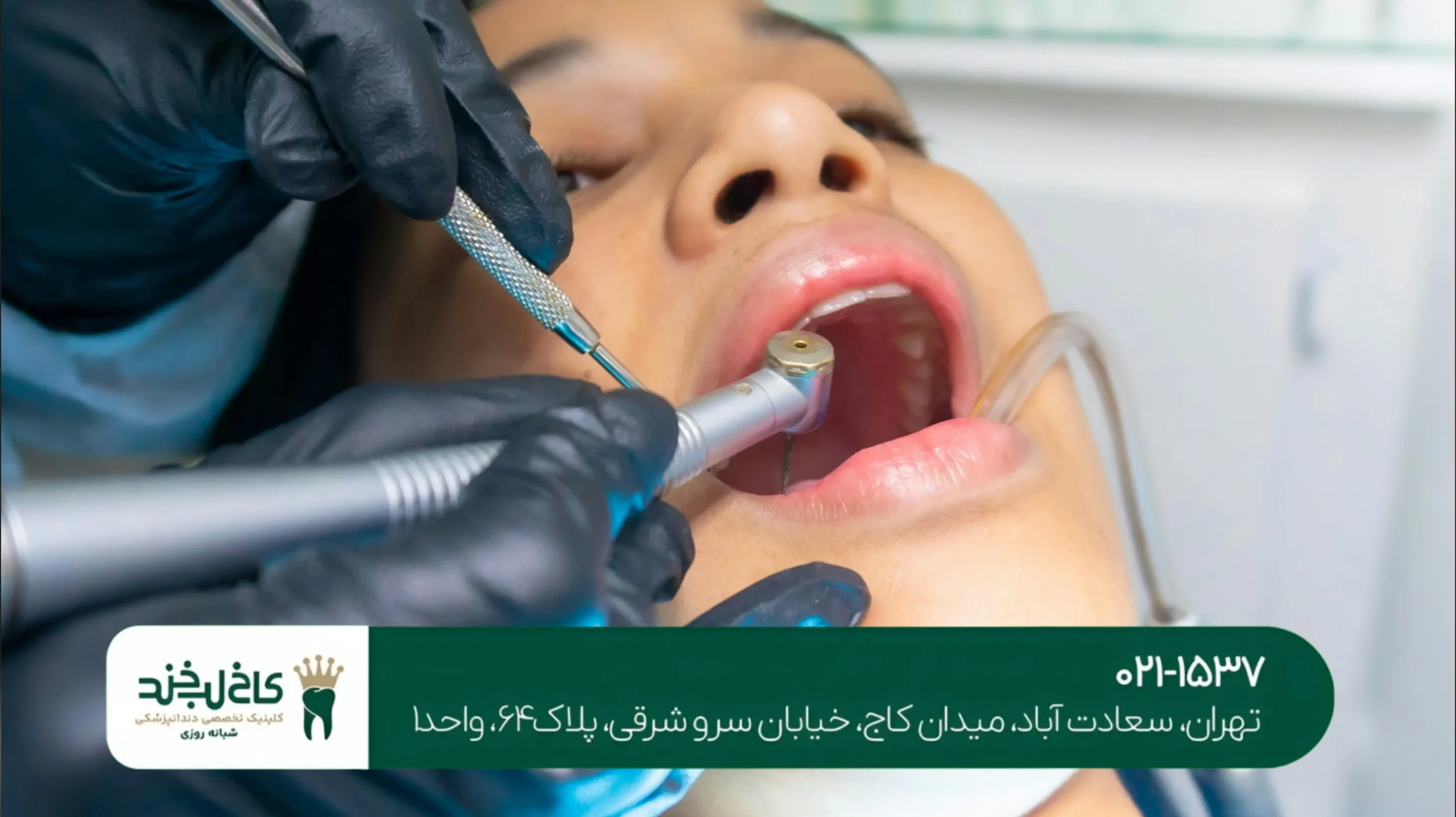 درمان دندان درد شدید با لیزر