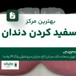 بهترین مرکز سفیدکردن دندان