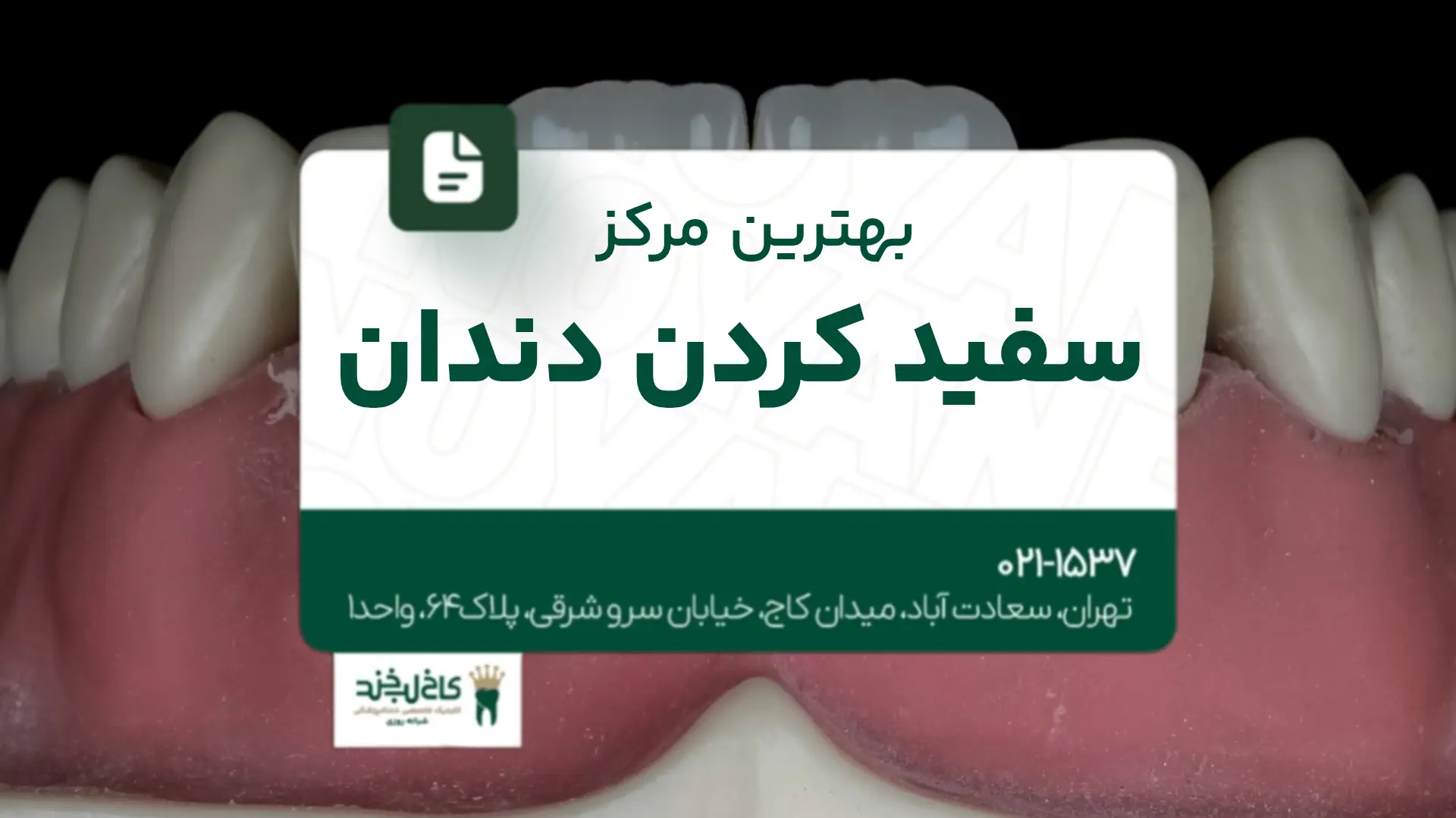 بهترین مرکز سفیدکردن دندان در تهران