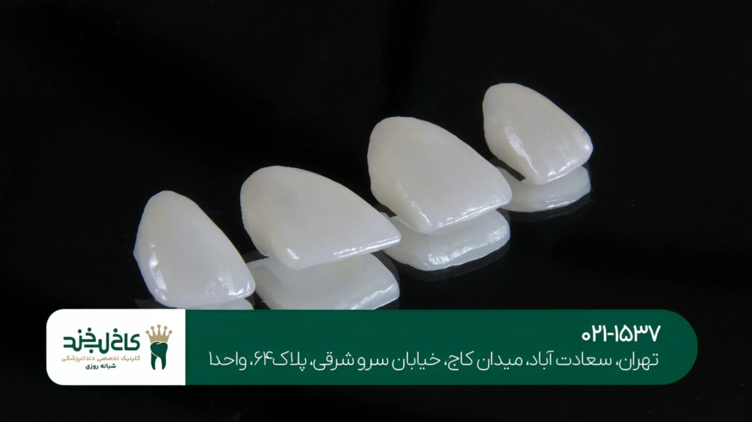 بهترین مرکز سفیدکردن دندان در تهران