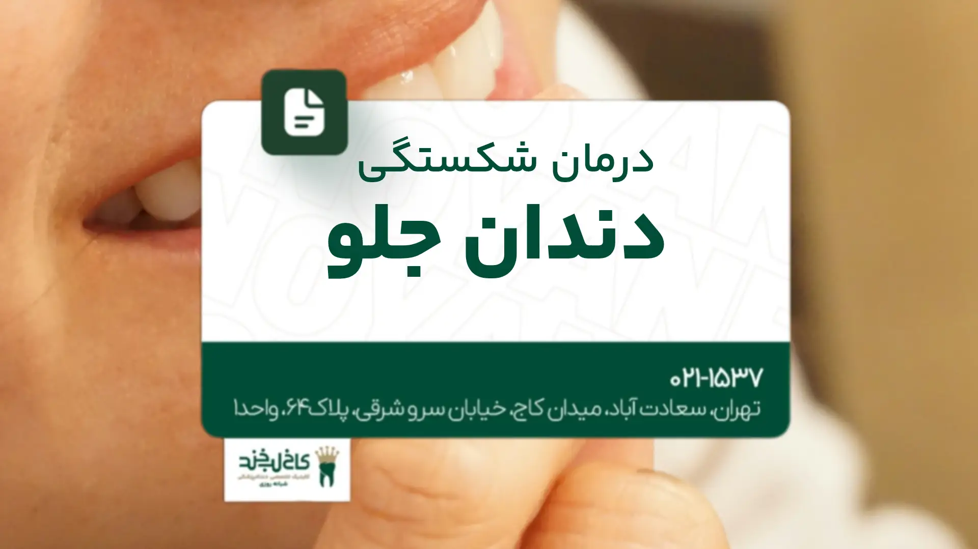 درمان شکستگی دندان جلو