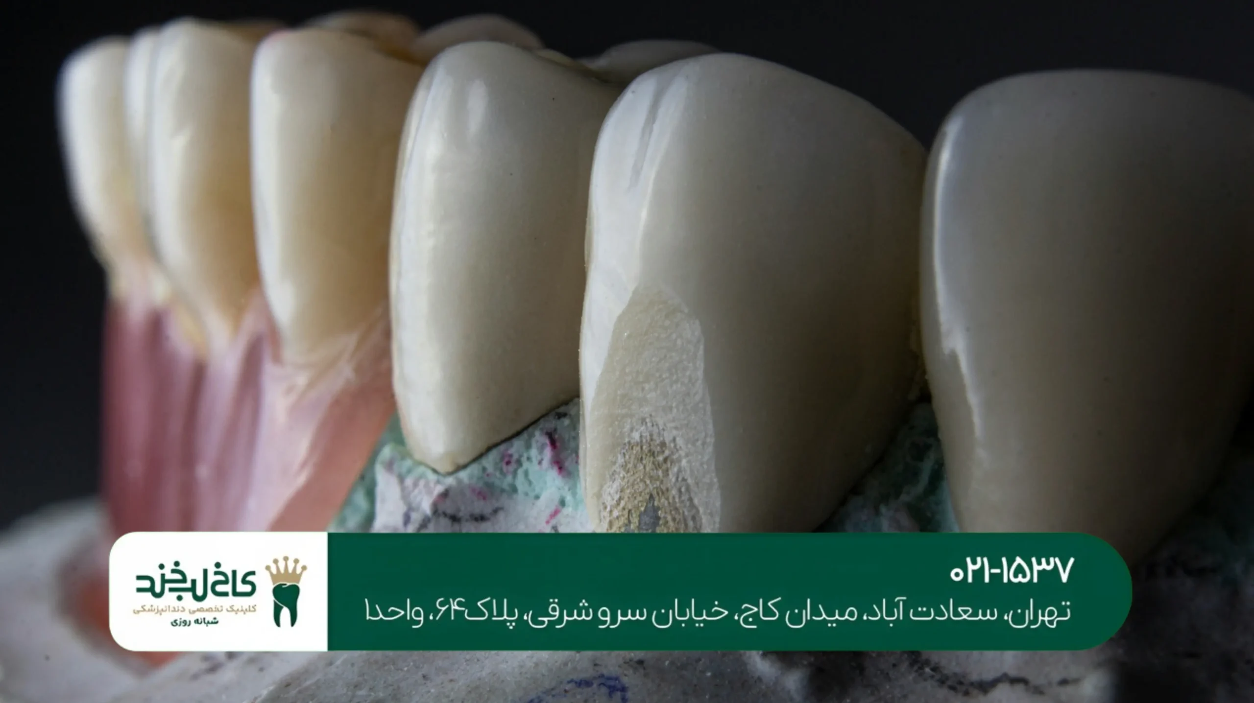 لمینت اقساطی با قیمت مناسب