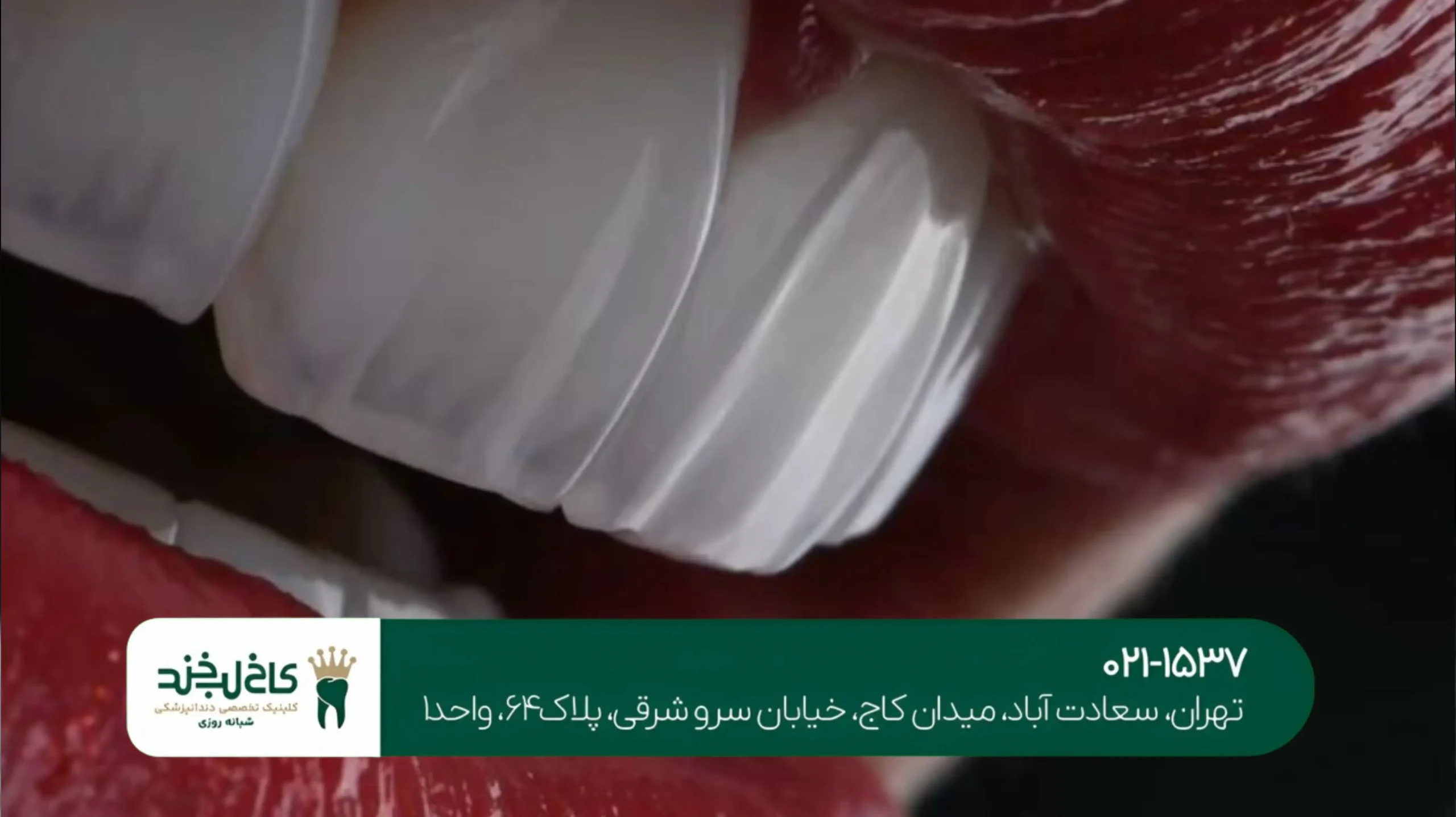 لمینت اقساطی با قیمت مناسب