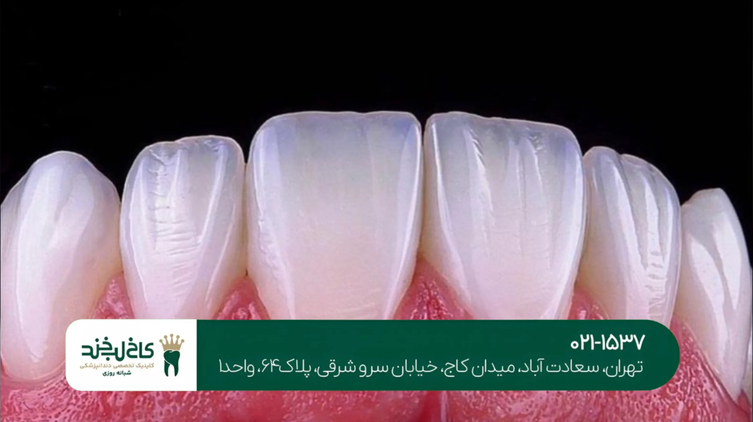 لمینت اقساطی با قیمت مناسب